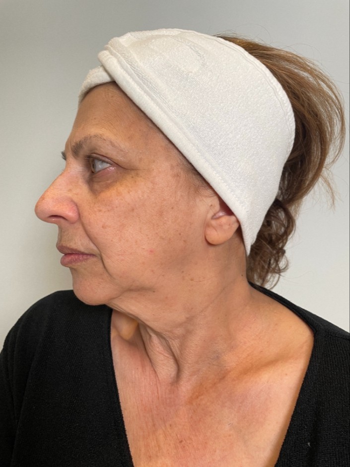 Before Image