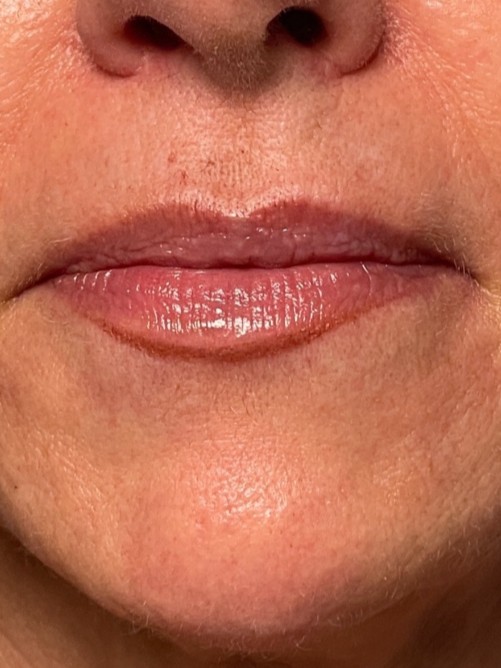 After Image