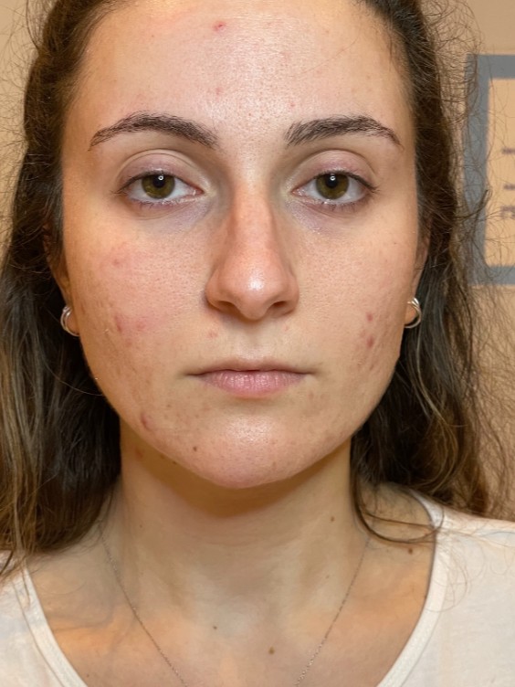 After Image