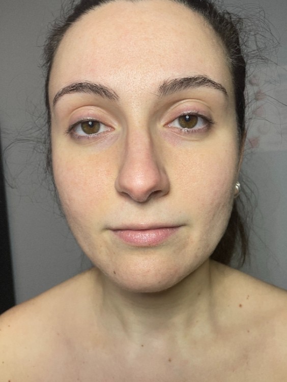 Before Image