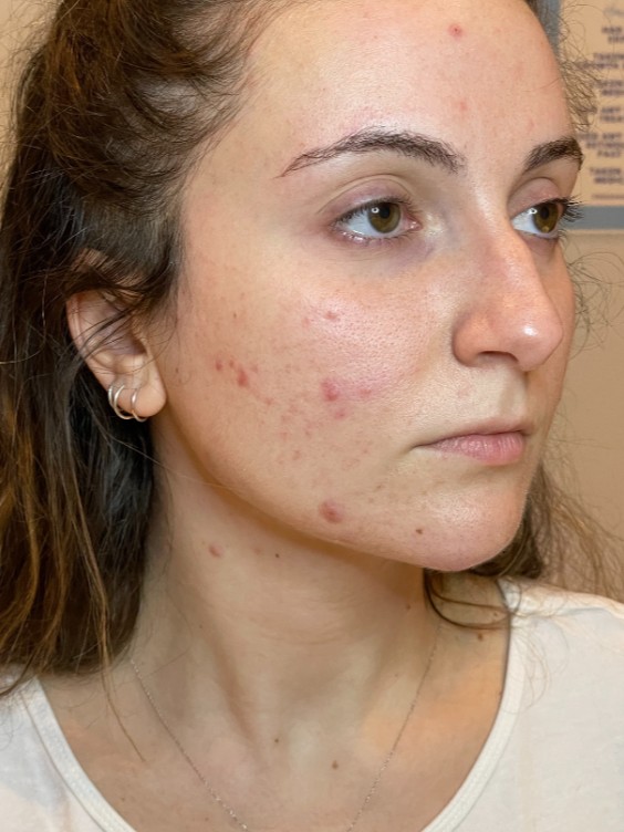 Before Image