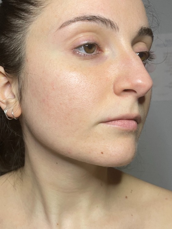 After Image