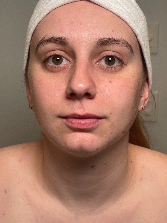 Before Image
