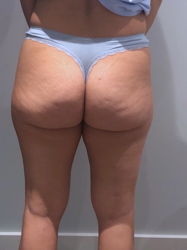 Before Image