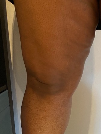After Image