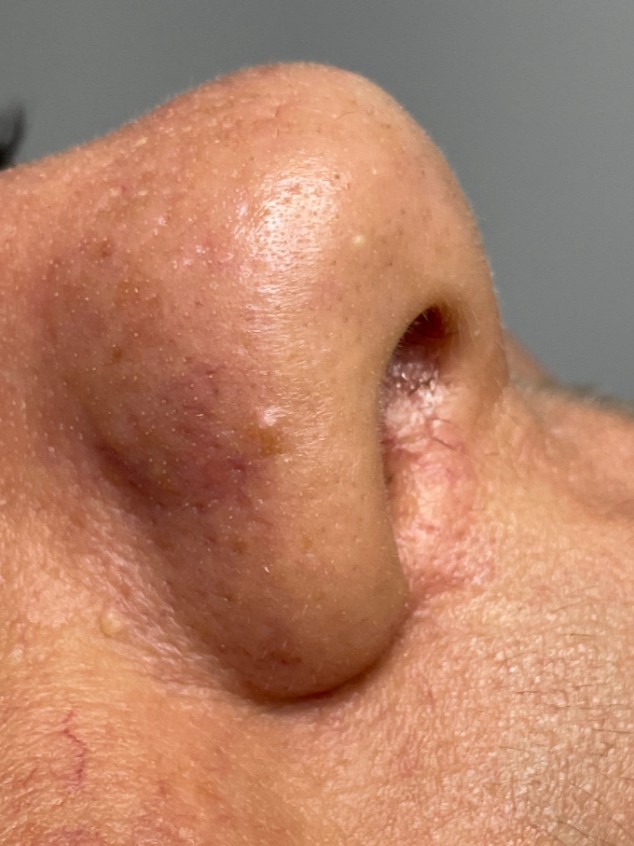 After Image