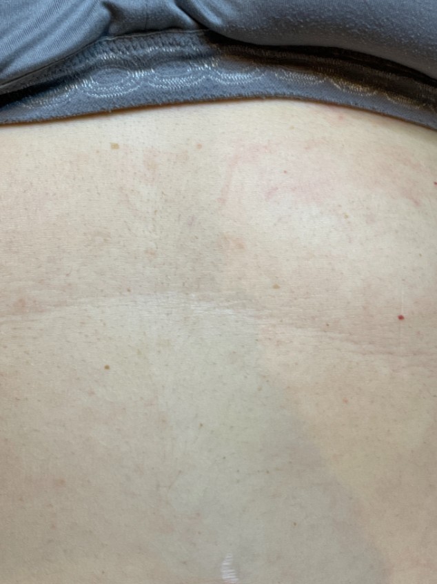 After Image