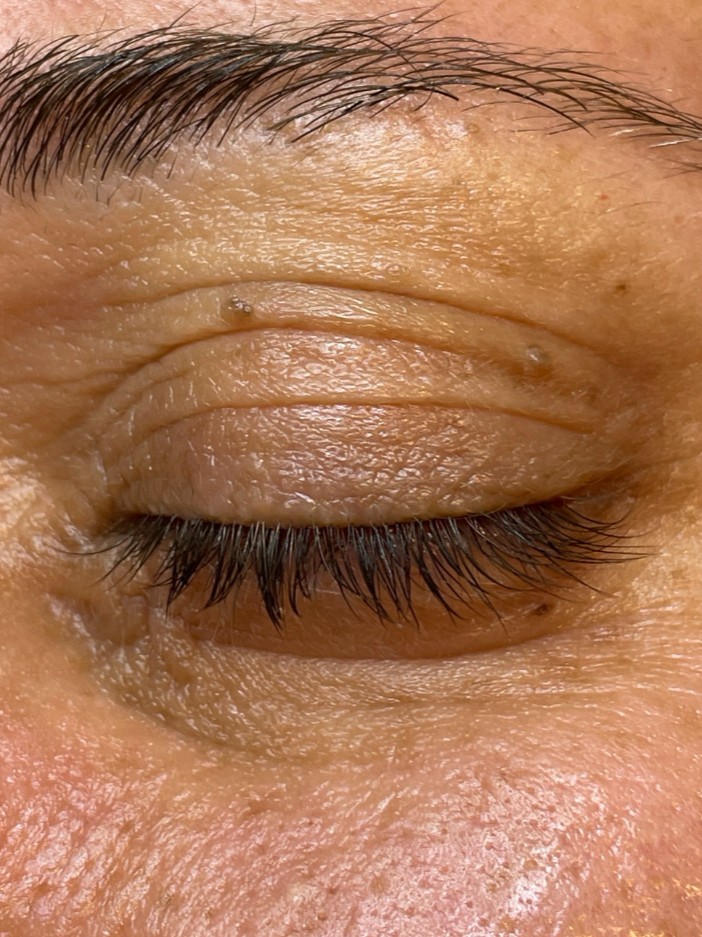 Before Image