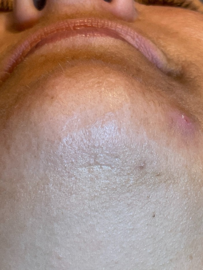 After Image