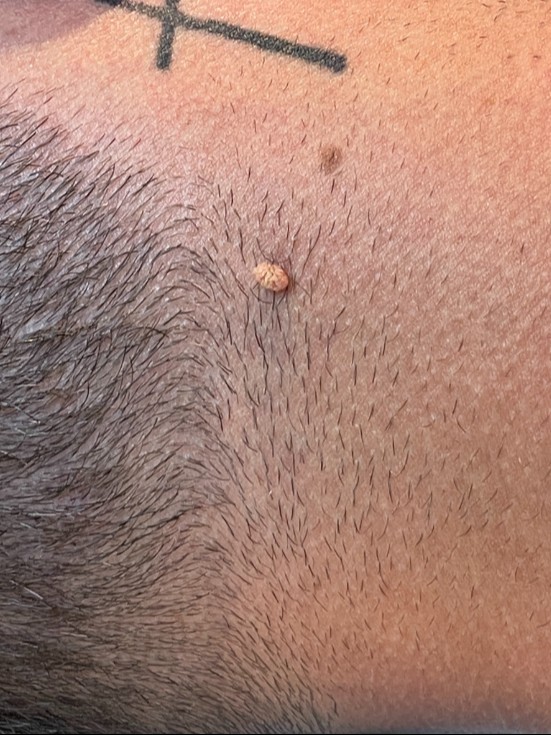 Before Image