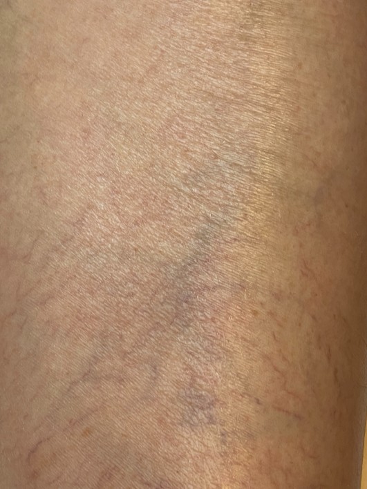 After Image