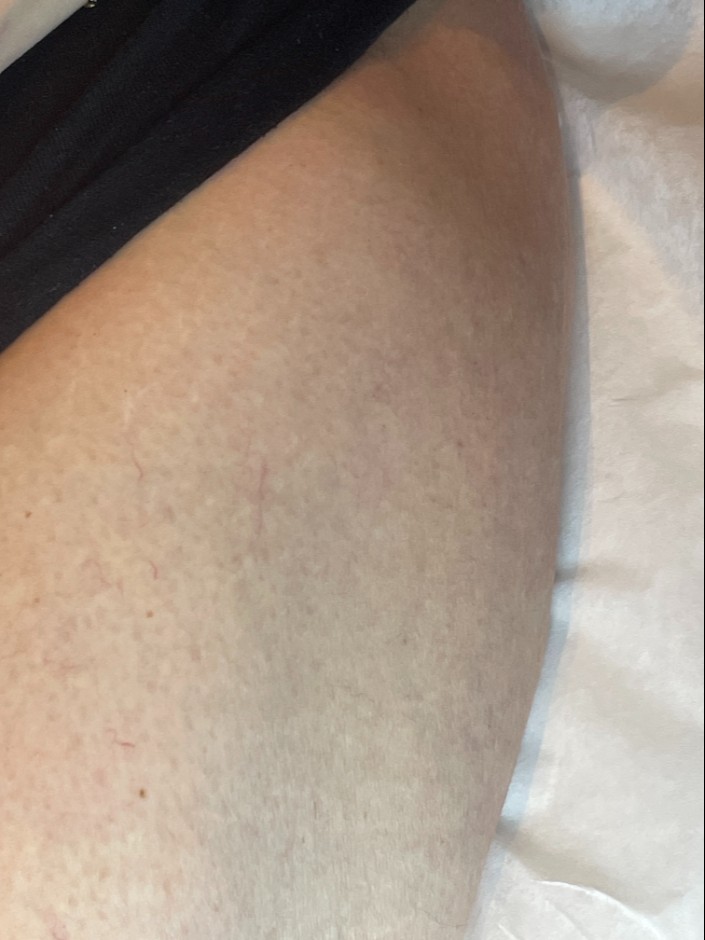 After Image