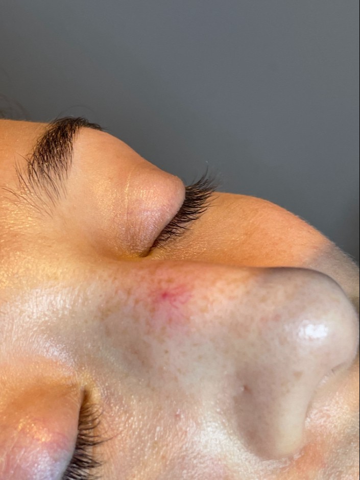 Before Image