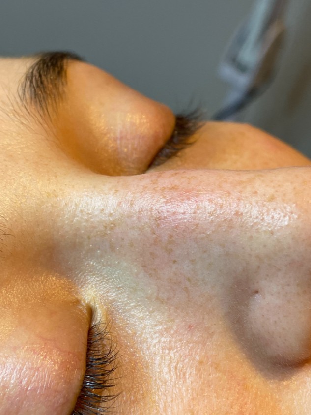After Image