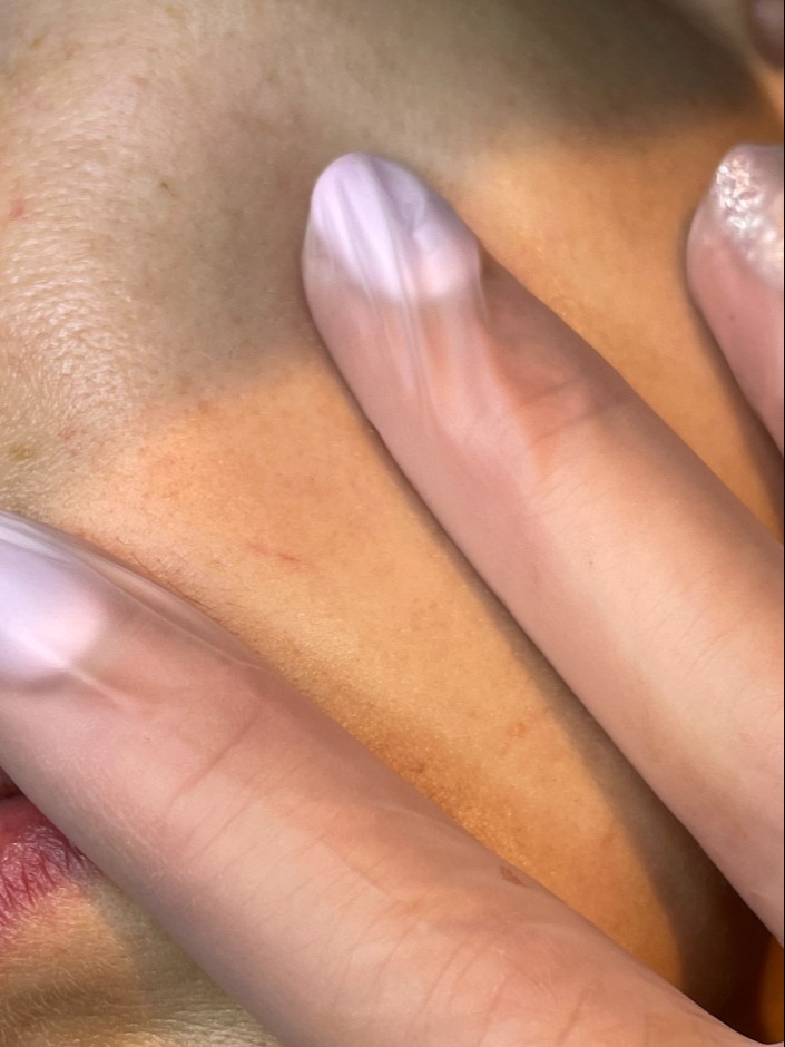After Image