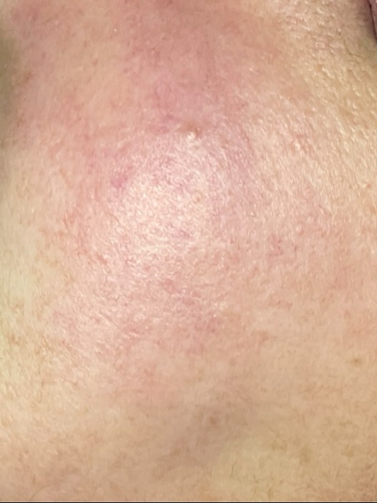 After Image
