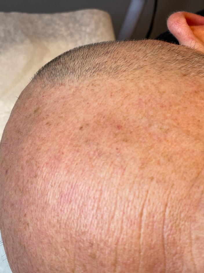 Before Image