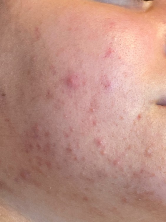 Before Image