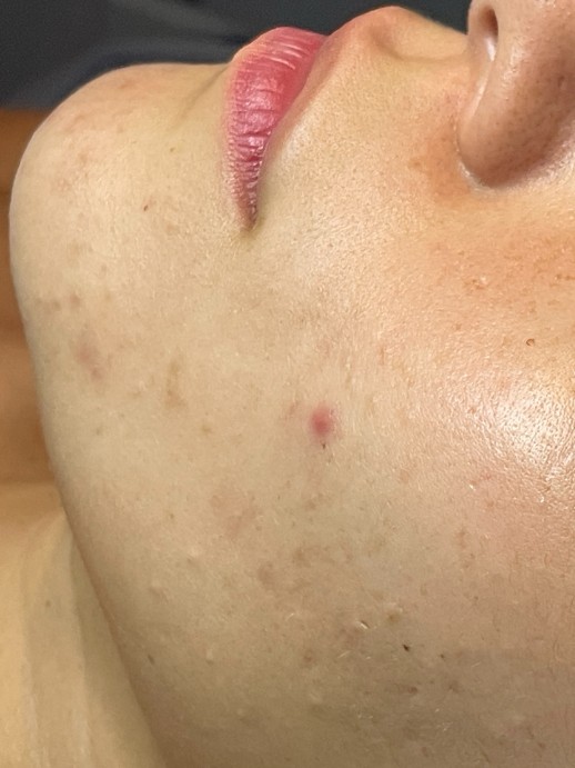 After Image
