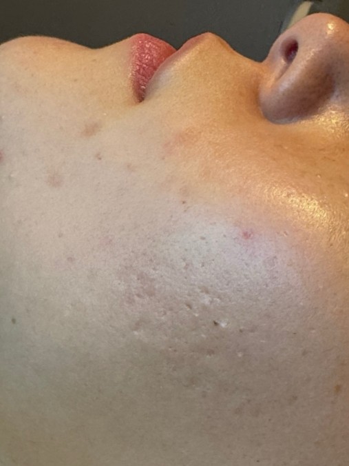 Before Image
