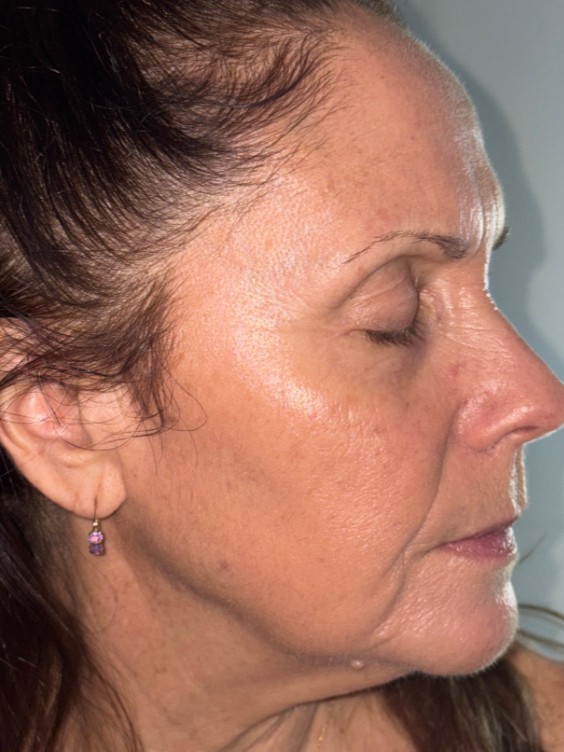 After Image