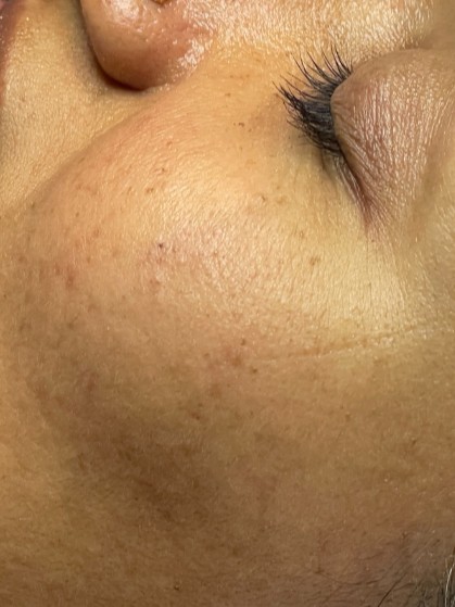 After Image
