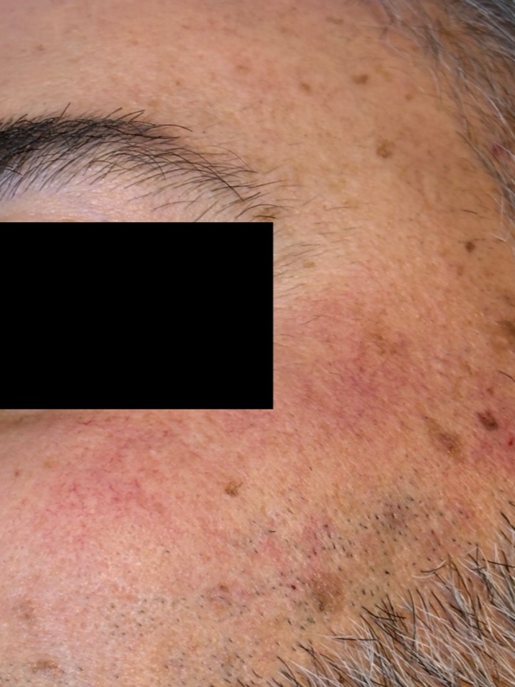 After Image