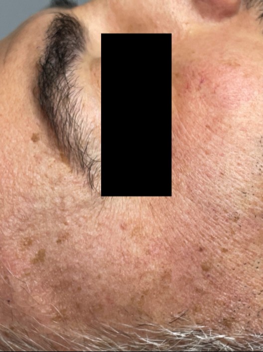 Before Image