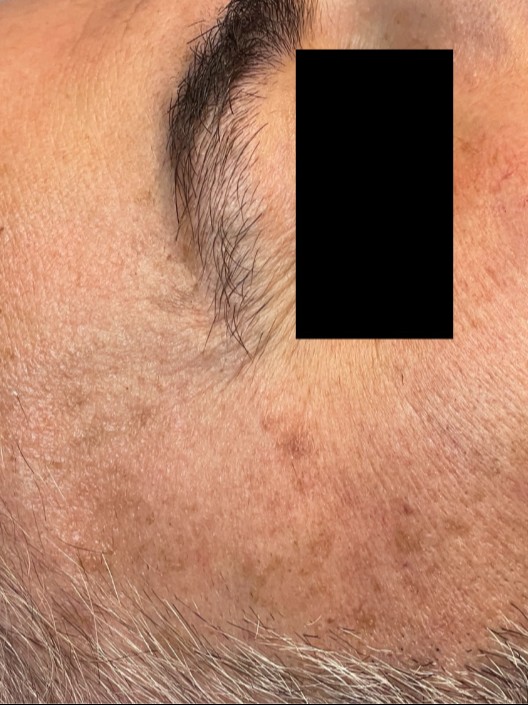 After Image