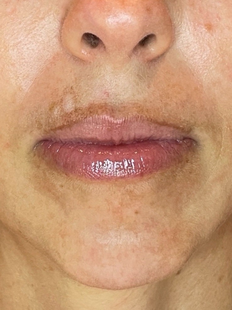 Before Image