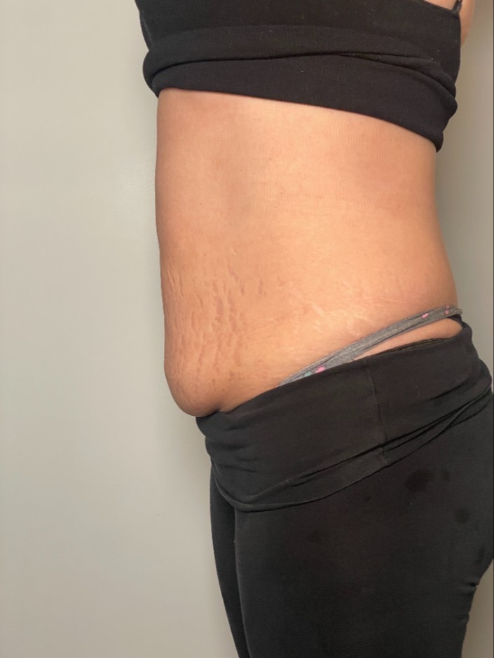 Before Image