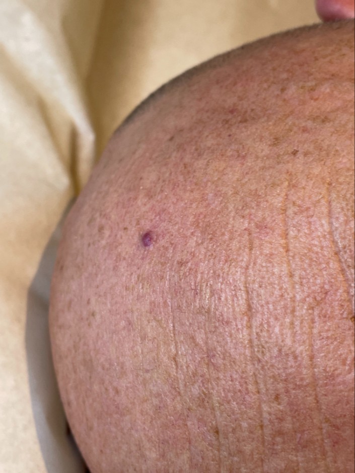After Image