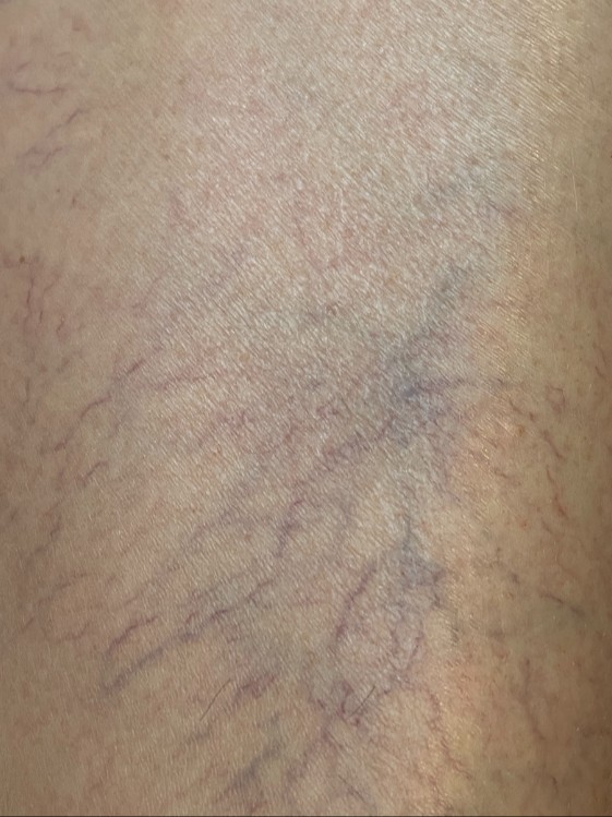 After Image