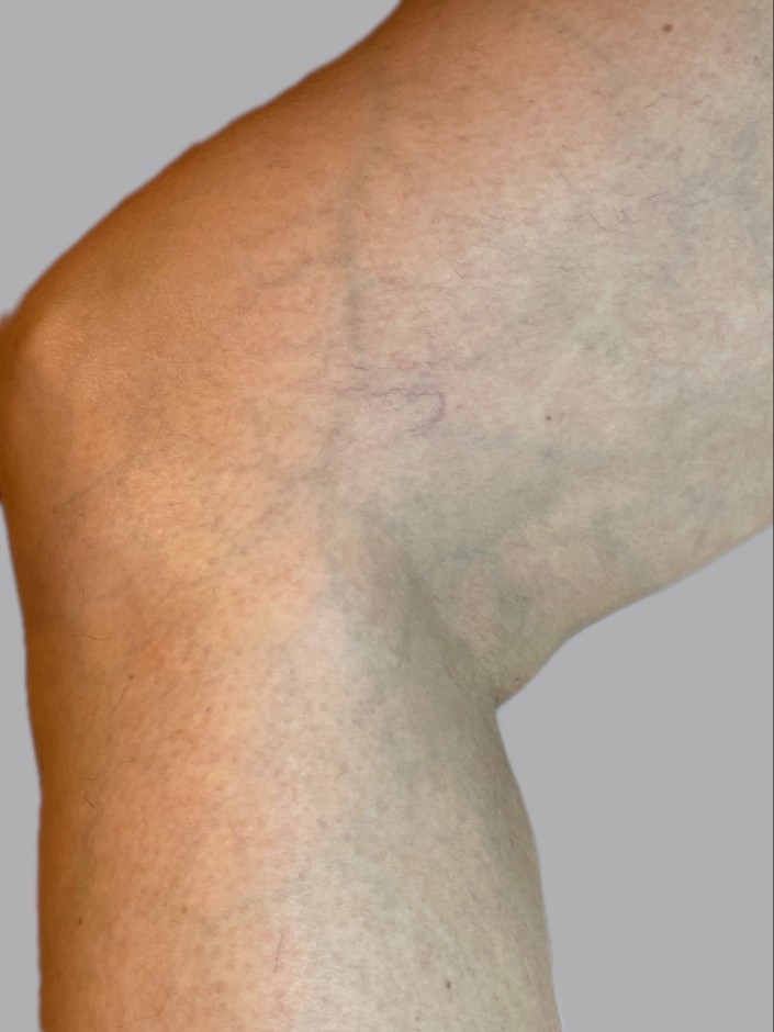 After Image