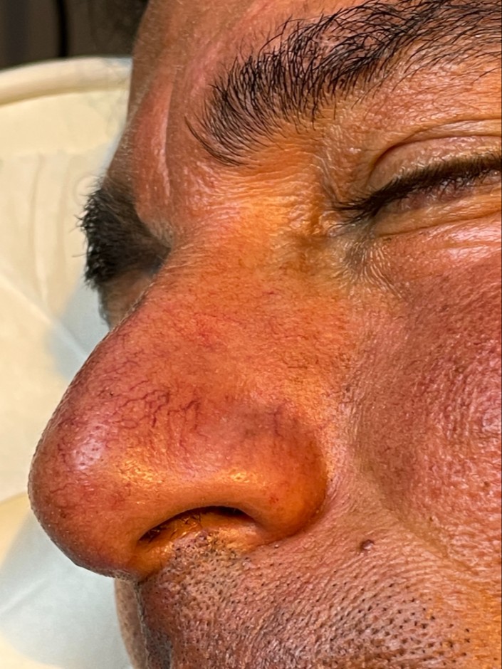 After Image