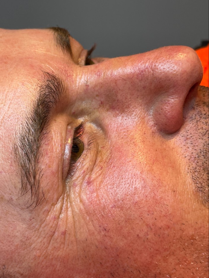 Before Image